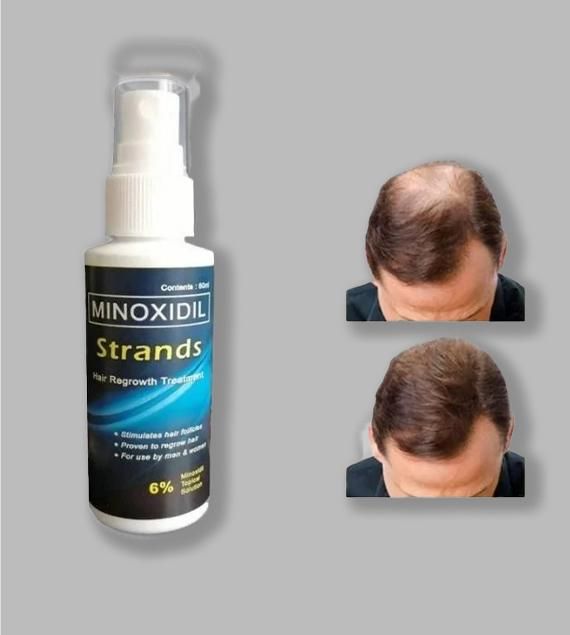 ReGrow Max: 6% Minoxidil Topical Solution for Men (60ml)